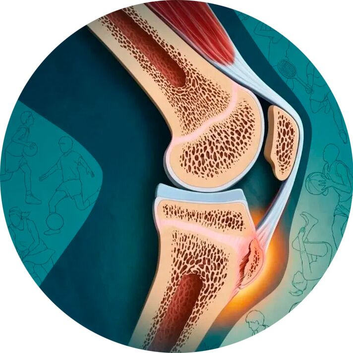 Az ízület és a környező szövetek szerkezete