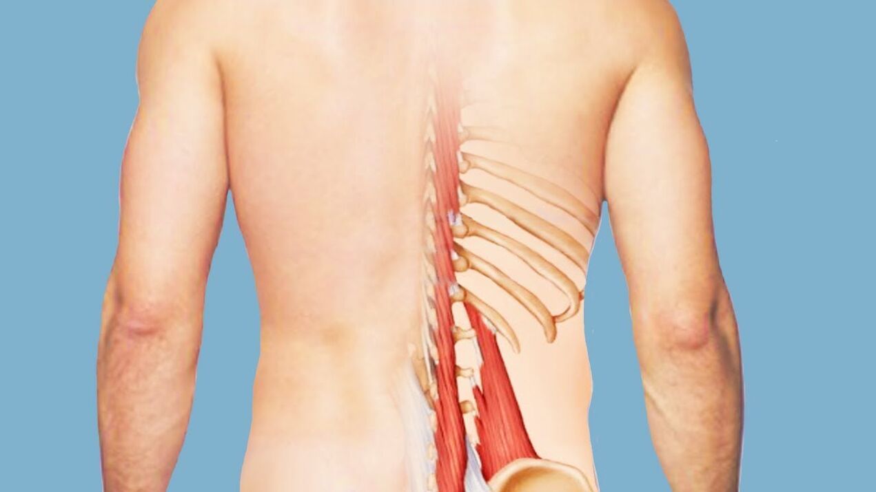 myositis, mint a derékfájás oka